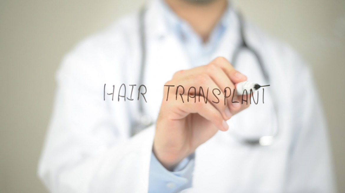 Lekarz pisze hair transplant