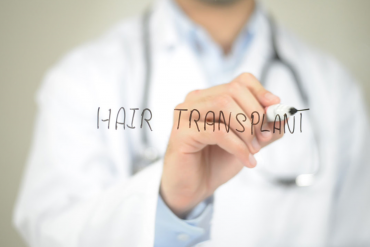 Lekarz pisze hair transplant