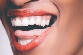 Uśmiechnięta kobieta z implantami zębów