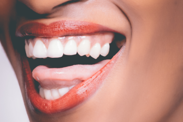 Uśmiechnięta kobieta z implantami zębów